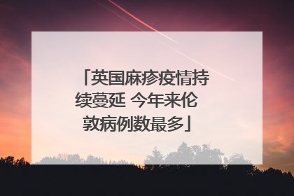 英国麻疹疫情持续蔓延 今年来伦敦病例数最多